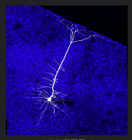 Single Neuron in Mouse Visual Cortex